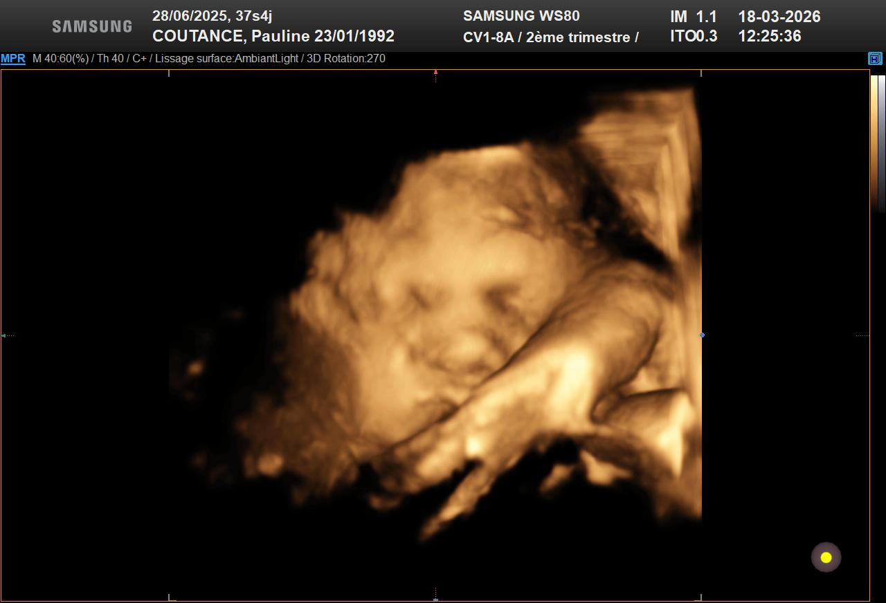 Échographie de Cunégonde